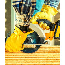 Frais de personnalisation